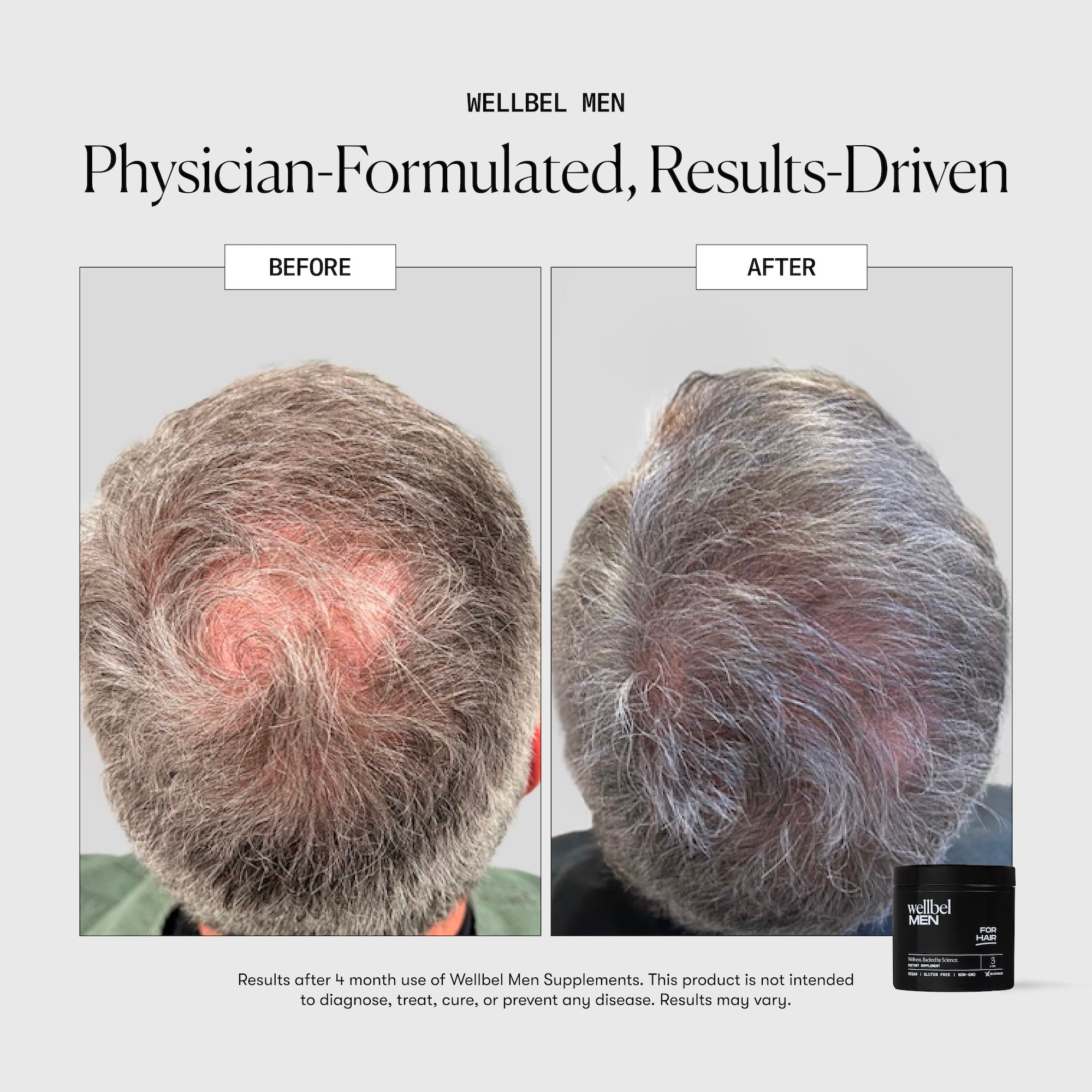 Wellbel Men Hair Supplement
