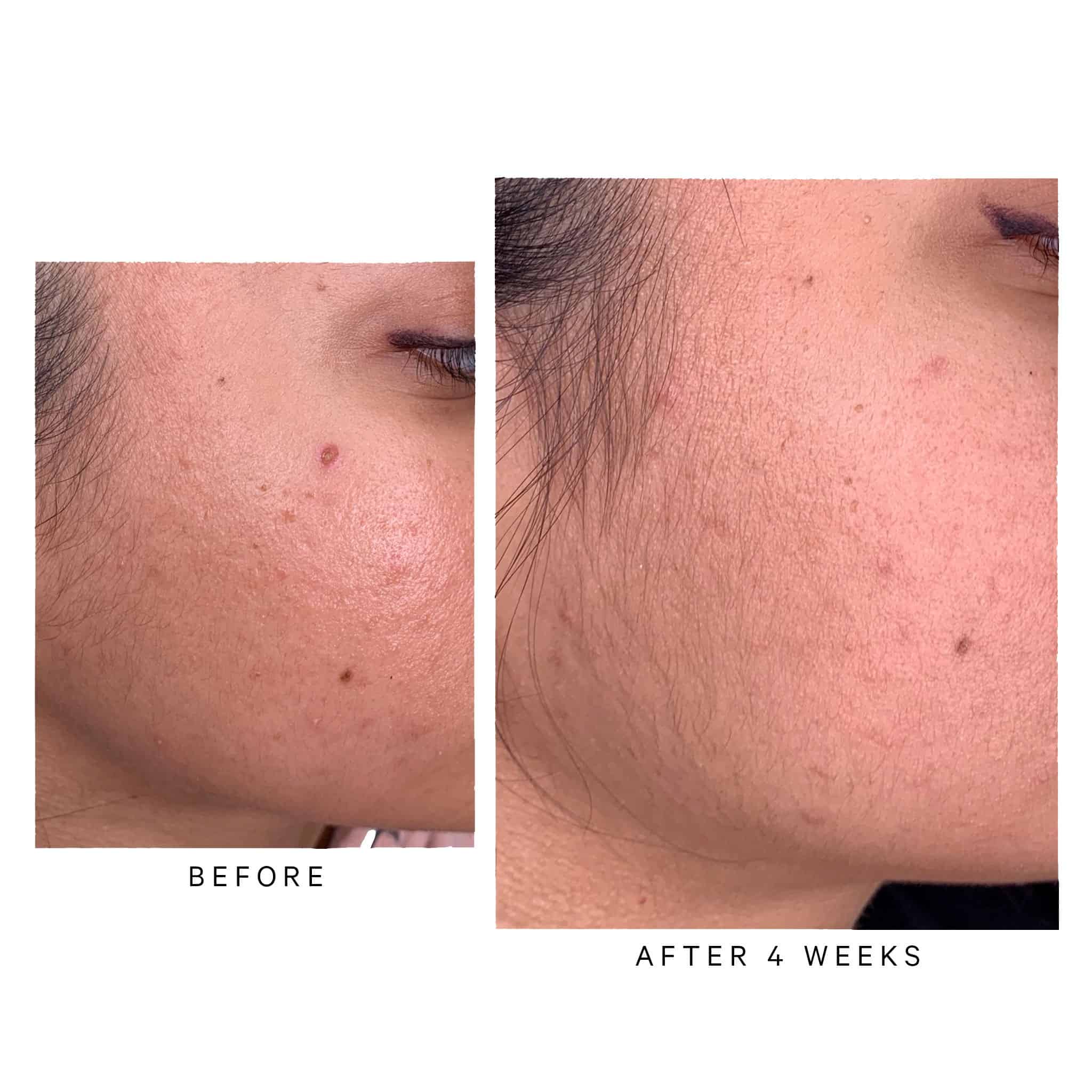 MZ Skin Retinol Skin Booster