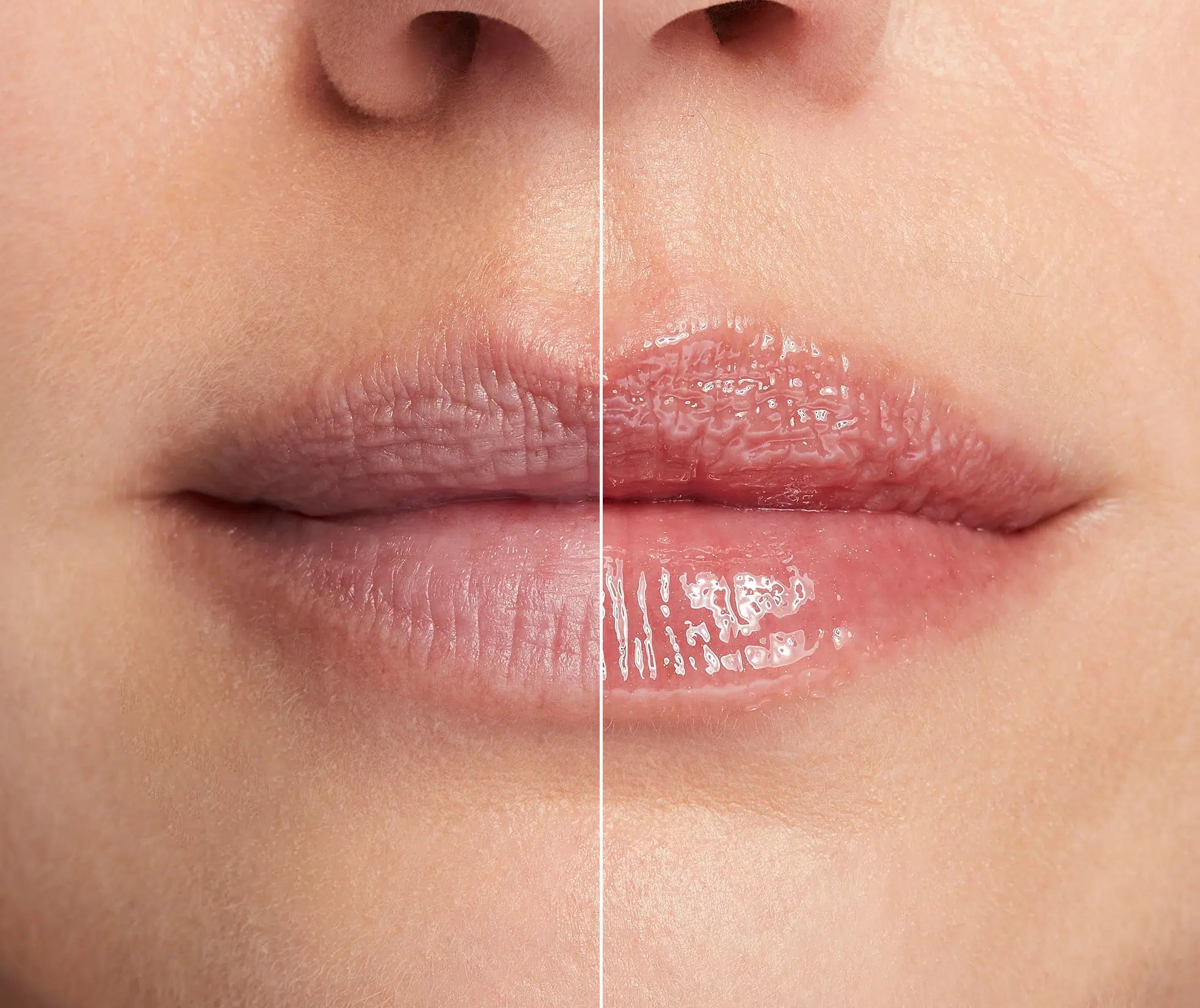 MZ Skin Volumising Lip Perfector